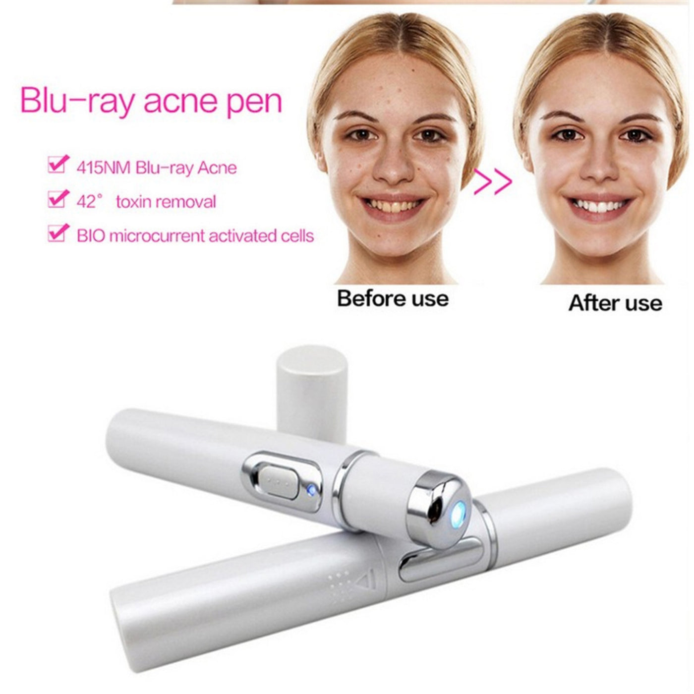 Blue Light Therapy Acne Laser Pen Soft Scar Wrinkle Removal Treatment Device Skin Care Beauty Equipment - HJG