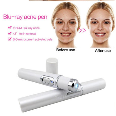 Blue Light Therapy Acne Laser Pen Soft Scar Wrinkle Removal Treatment Device Skin Care Beauty Equipment - HJG