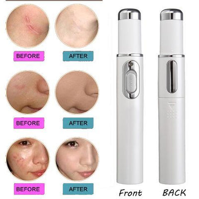 Blue Light Therapy Acne Laser Pen Soft Scar Wrinkle Removal Treatment Device Skin Care Beauty Equipment - HJG